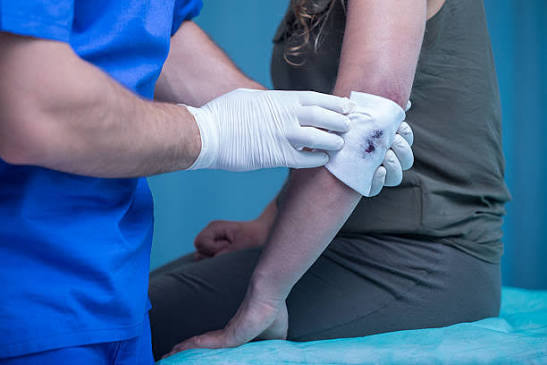 Best Elbow Surgery Doctor in South Mumbai