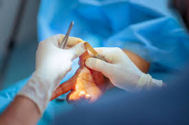 Best Hand Surgeon Treatment in South Mumbai