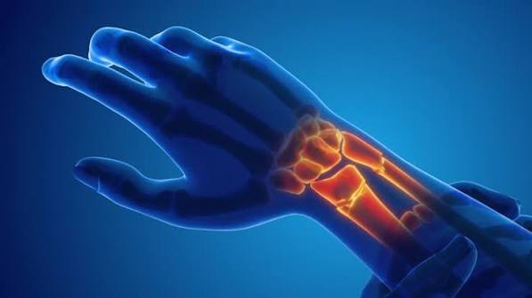 Best Wrist Fractures Treatment in South Mumbai